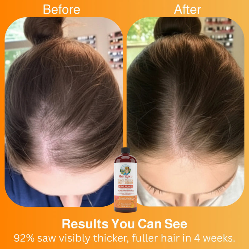 Liquid Morning Multivitamin + Hair Growth 15.22 oz